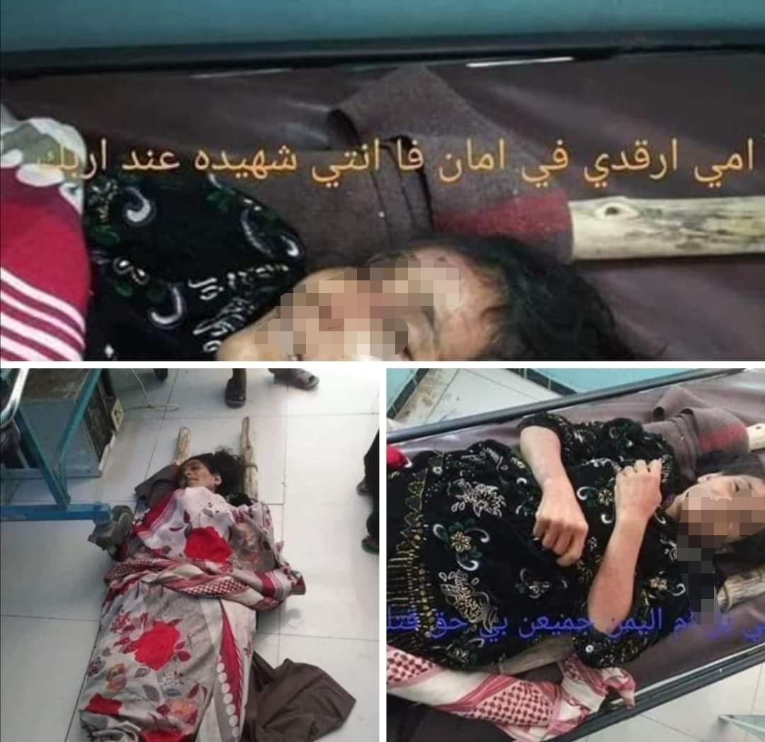 بالصور.. أب يمني يعتدي على ابنته في منزل زوجها بالضرب حتى الموت