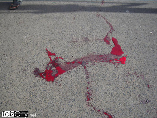 دم أحد الشهداء الذين سقطوا في محافظة تعز 11\\\\5\\\\2011م