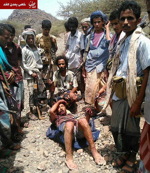 اسير من مقاتلي جماعة الحوثي بجبهة المضاربة يوم الجمعة (عدن الغد)