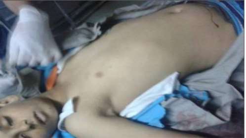 مقتل طفل وجرح شخص اخر بانفجار لغم ارضي بالعاصمة صنعاء