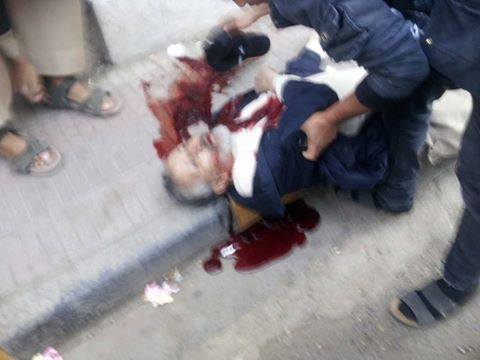 مسلح يطلق النارعلى الدكتور محمد عبدالملك المتوكل في شارع العدل ب