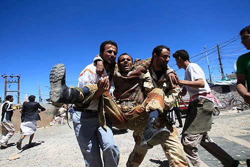 سقط عدد من القتلى والجرحى في مواجهات صنعاء