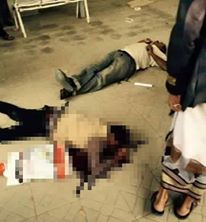 مقتل مواطنين اثنين وإصابة 4 آخرين برصاص مسلحي الحوثي أمام مصلحة الجوازات في العاصمة صنعاء