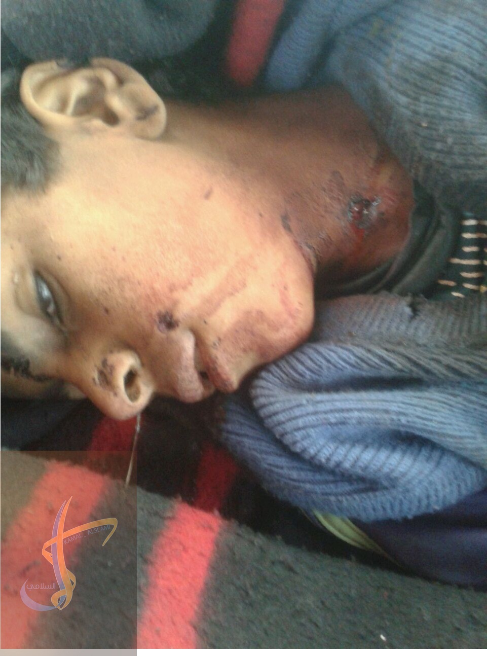  مليشيا الحوثي ترتكب مجزرة بحق الأطفال في قرية الغول بمديرية الزاهر بالبيضاء (أسماء الضحايا)