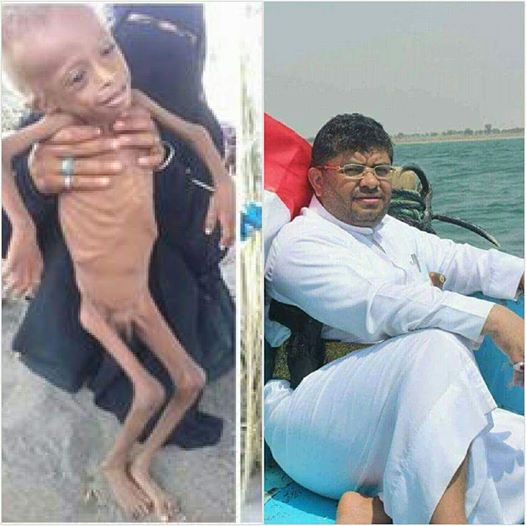 الحوثيون يواجهون موت أطفال الحديدة من الجوع بـ «النزهة»! (صورة)
