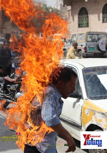 شاب يمني يحرق نفسه أمام مجلس الوزراء احتجاجاً على إهمال جرحى الثورة