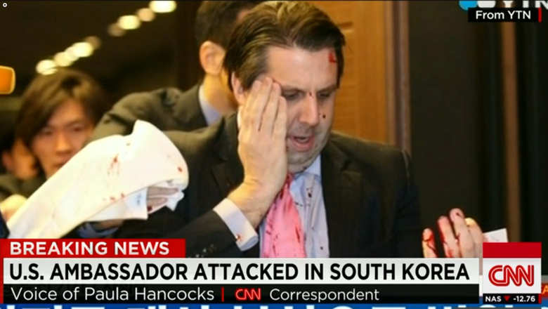 من هو المشتبه به بالاعتداء على السفير الأمريكي في كوريا الجنوبية؟
