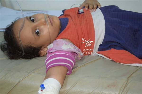 شذى طفلة يمنية كانت تمارس اللعب مع قريناتها فاستهدفتها رصاصة قنّاص حوثي