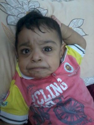 بالفيديو .. طفل يمني يناشد الملك سلمان لعلاجه