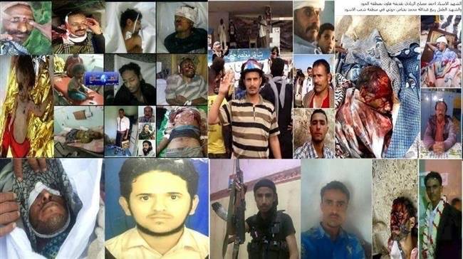 الضالع (١٨٧) شهيد و(٤٣٤) جريح خلال (١٠٠) يوم من حرب الحوثي وقوات صالح على الضالع (تقرير)