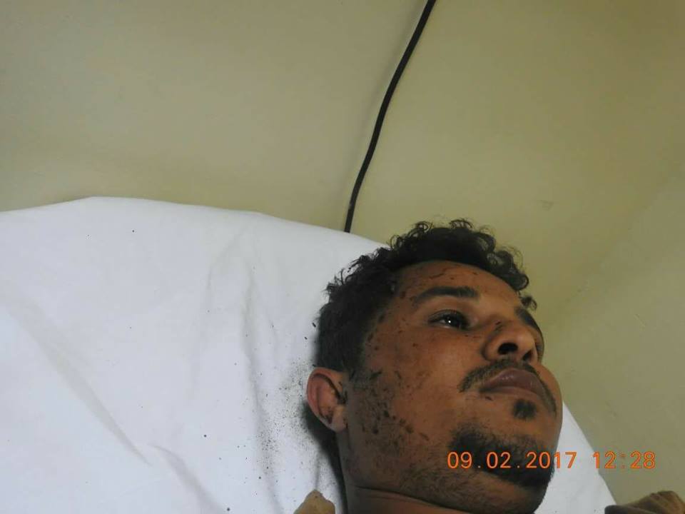 إصابة الصحفي «أسامه فراج» أثناء تغطيته المعارك في جبهة ميدي والمنطقة الخامسة تشيع جثمان الشهيد الحربي