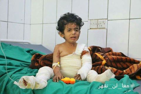 شاهد صورة طفل مصاب.. توفي جميع إفراد أسرته جراء قصف المليشيات لتعز