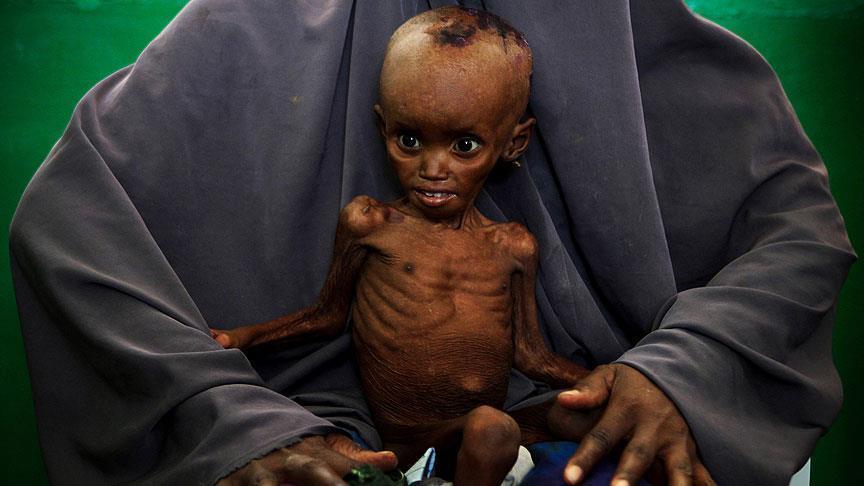 الأمم المتحدة:انعدام الأمن الغذائي يهدد 17 مليون يمني