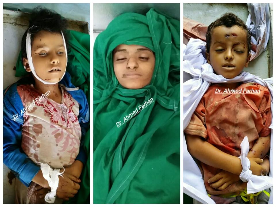 تقرير: مقتل 647 طفلا وإصابة 822 آخرين جراء الحرب التي تشنها مليشيا الحوثي وصالح