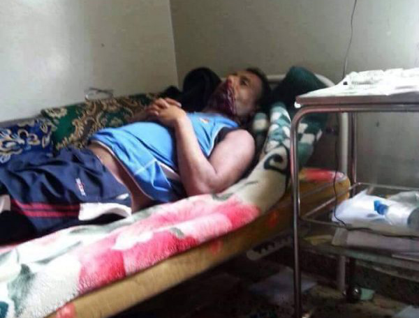 العثور على جثة مدير مستشفى حكومي في إب مقتولاً في ظروف غامضة