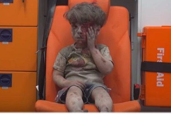صورة الطفل «عمران» الأكثر تداولاً حول العالم تُظهر وحشية النظام السوري