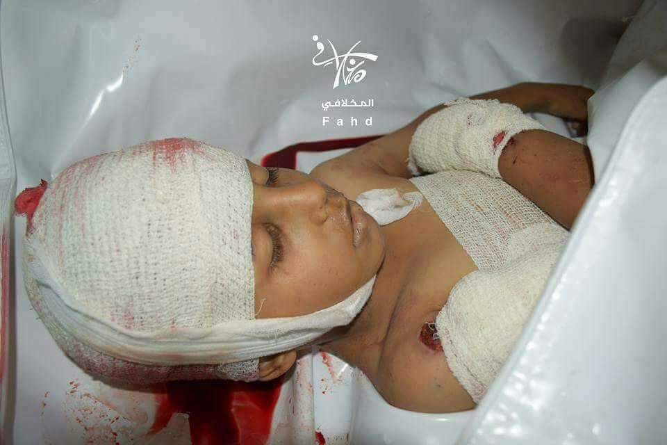 مقتل 4 أطفال وإصابة آخرين بقصف شنه الحوثيون على حي الجحملية بتعز