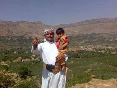 طبيب يروي  تفاصيل تعذيب الحوثيين لمختطف في سجونهم: «أخصوه وأصابوه بالشلل»