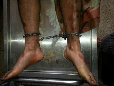 تعذيب مختطفين في أحد سجون عدن (صور)