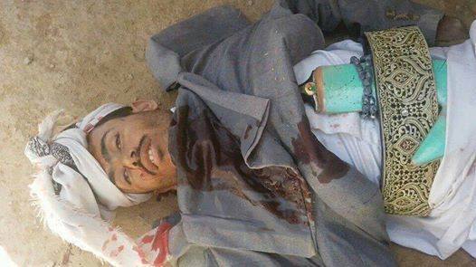 صورة لمسلح حوثي قُتل اليوم في مدخل الضبر بمدينة عمران نشرها ناشط