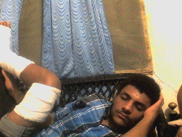 جريح في الثورة اليمنية يطرد من المستشفى في الهند ويتحول الى مشرد في محطة باصات