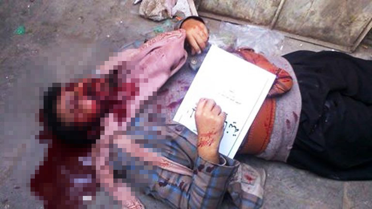 القيادي الحوثي فيصل الشريف بعد إغتياله اليوم
