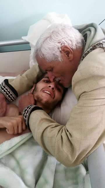 شاب اختطفته مليشيا الحوثي وهو مصاب وتركته بدون علاج لـ8 أشهر إلى أن فقد الحركة والنطق
