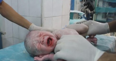 ‏بالفيديو.. أغرب ولادة في تاريخ الثورة السورية