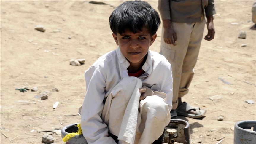 الأمم المتحدة: نصف مليون طفل يمني يوشكون على الموت
