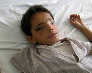 الطفل سليم وهب ثورة اليمن عينيه فأهملته