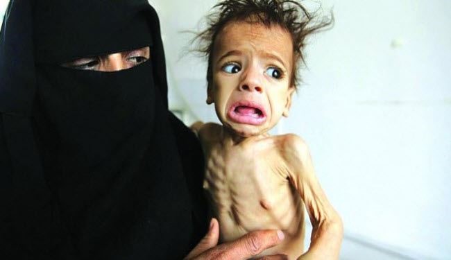 14 مليون شخص بحاجة لغذاء في اليمن