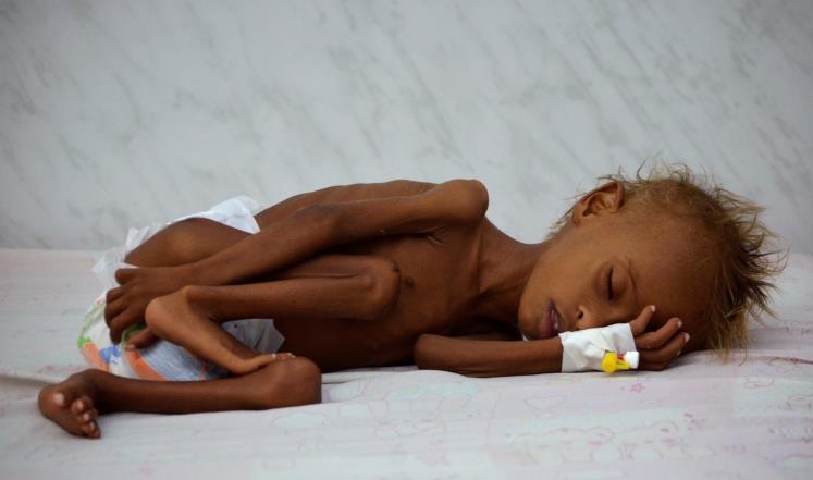 منسقة الأمم المتحدة للشؤون الإغاثة يأسف لوصول اليمن لحافة المجاعة