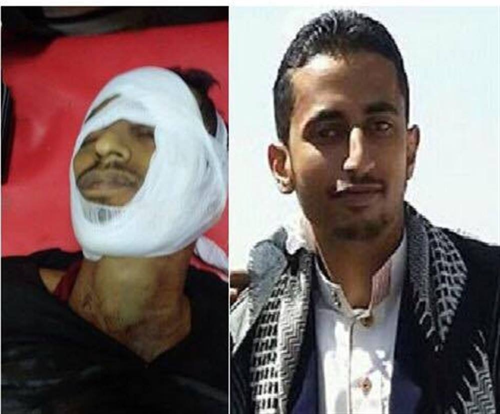 مليشيا الحوثي في محافظة إب تقتل شاب وتُصيب آخر بسوق الظهار