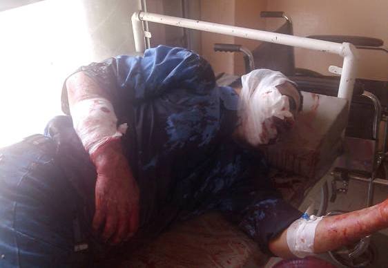 إصابة ضابط كبير في المخابرات اليمنية في محاولة اغتيال بمحافظة تعز (صورة)