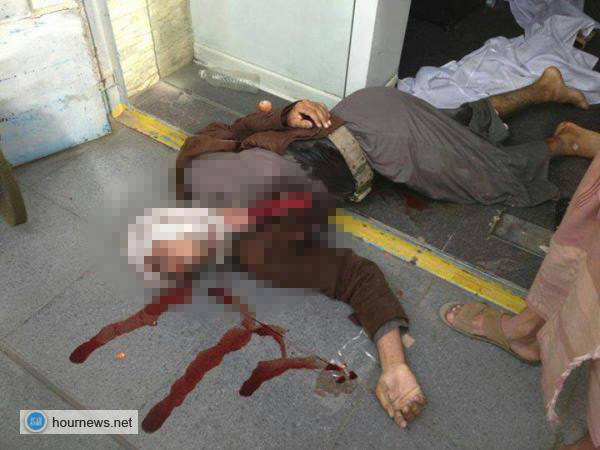 نشر صورة أحد المسلحين القتلى الذي حاولو اختطاف مواطن أجنبي في صنعاء
