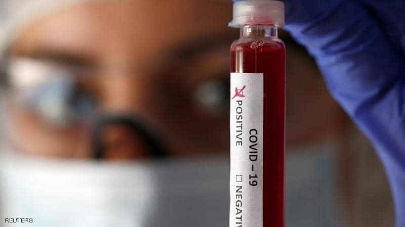 أبحاث تكشف عن فصيلة الدم الأكثر عرضة لخطر كورونا