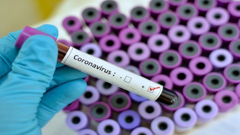 السعودية تصدر بياناً عاجلاً بشأن فيروس كورونا