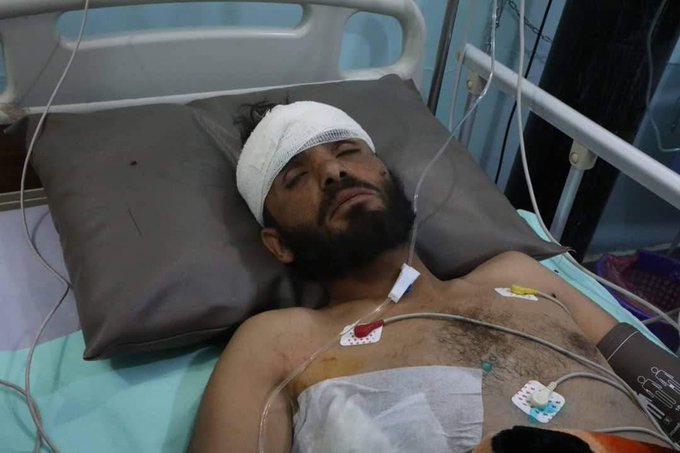 شاهد كيف ظهر القيادي الحوثي الجريح بعد أسره في محافظة الجوف
