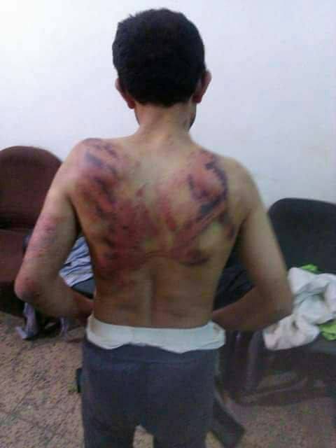 قيادي حوثي يختطف مواطن من العاصمة صنعاء ويعذبه بوحشية