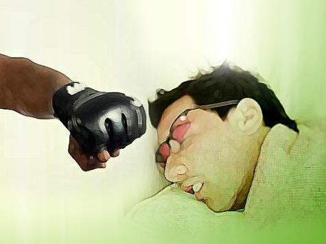  قلة النوم لكمة قوية ومؤذية تسدد إلى رأسك 