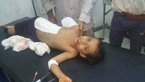 مقتل خمسة أطفال وجرح آخرين بقصف للحوثيين على حي عنصرة السكني بتعز