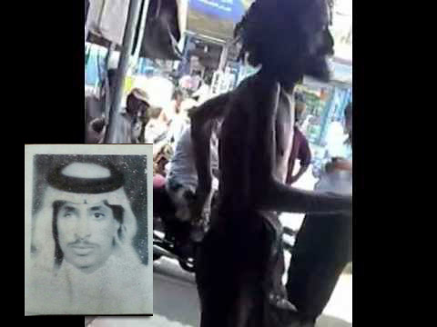 بعد سنوات على ضياعه.. أسرة سعودية تتعرف على ابنها الضائع في فيديو «مجنوناً» في أحد شوارع اليمن
