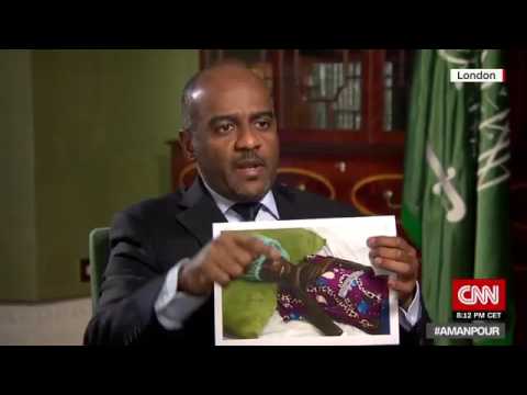 بالفيديو.. «اللواء عسيري» يقلب الطاولة في وجه مذيعة قناة «CNN» حول الجوع في تعز والحديدة