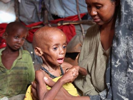 اليمن يأوي أكثر من مليوني لاجئ صومالي ويكلفون البلاد نحو 4.6 مليار دولار سنويا