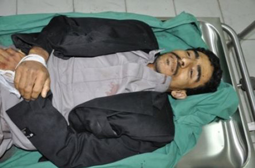 وزارة الداخلية تنشر صورة جثة المتهم الرئيسي في إغتيال دبلوماسي فرنسي واختطاف اجانب بصنعاء