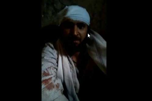 تسريب صور لمعتقل في سجون الحوثي وعليها أثار تعذيب وحشي