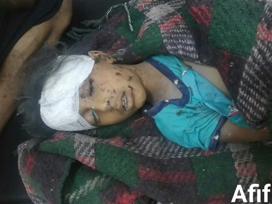 منظمة حقوقية: 33 طفلا يُقتلون شهريا في محافظتين يمنيتين فقط