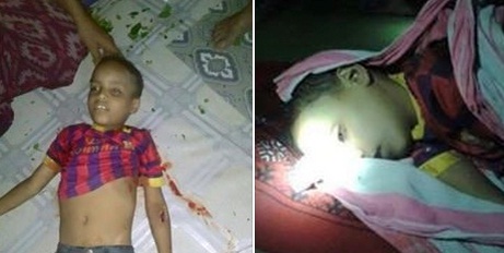 صور صادمة.. اليمنيون يتعاطفون مع الطفل البرشلوني