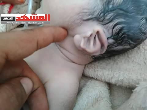 طفل يمني يولد وعلى أذنه مكتوب لفظ الجلالة  