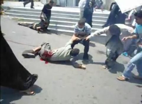 قتيل وعشرات المصابين بالرصاص في إطلاق قوات الأمن النار على مسيرة بتعز (فيديو وصور)